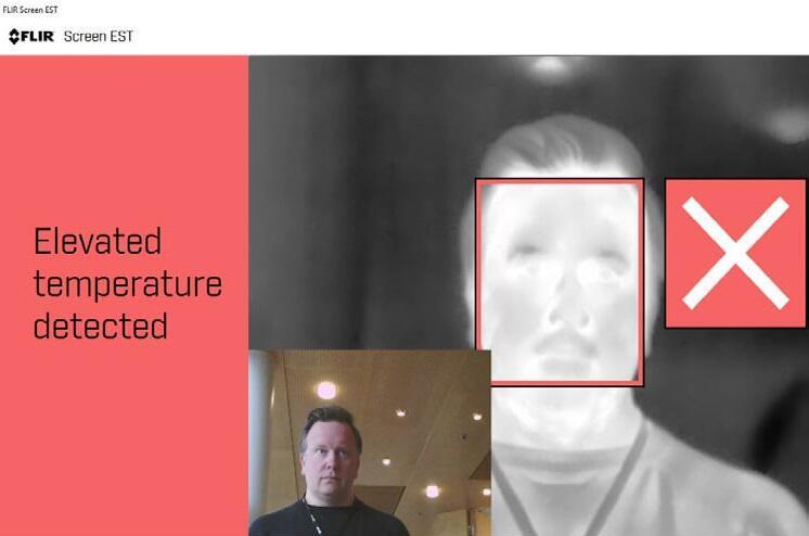 Software FLIR Screen-EST Kit pro kontrolu teploty pokožky